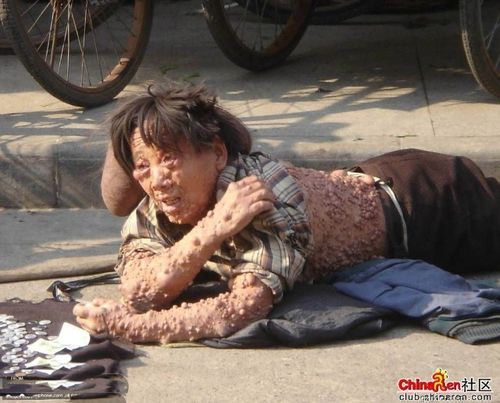 各种恶心图片挑战的你胃!