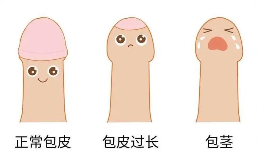 其它 科普:关于包皮那些事 写美篇 包皮是每个生理正常男性丁丁的"