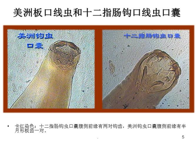 十二指肠钩虫和美洲钩虫ppt课件