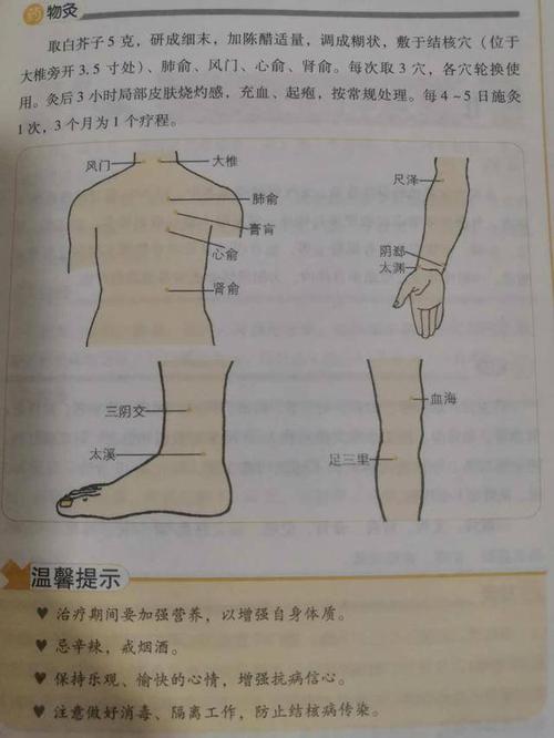 肺炎,肺结核艾灸方法及图解!收了吧!