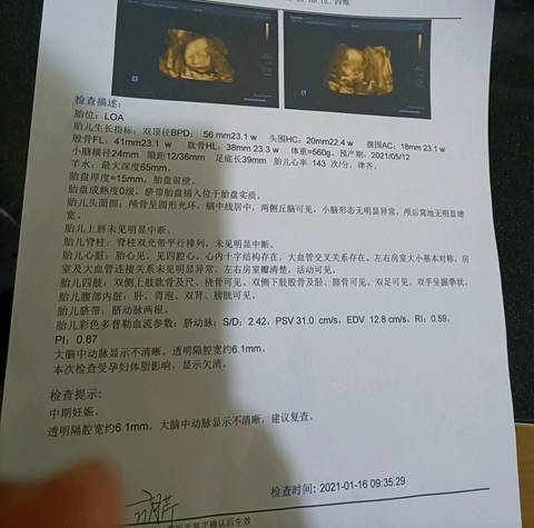 四维大家帮忙看看,是女宝还是男宝,谢谢