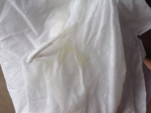 白带这样怎么回事?