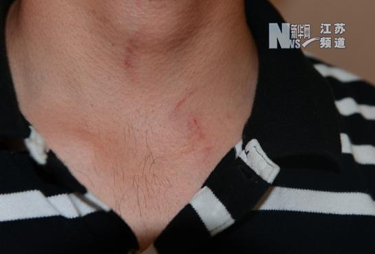 院方:电棍击人太恶劣