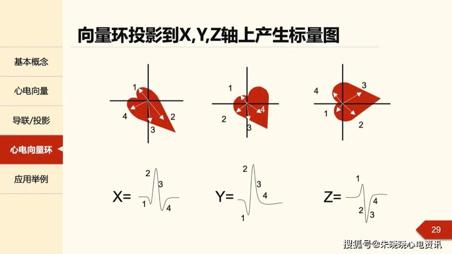 一文掌握心电向量:从基本原理到临床应用