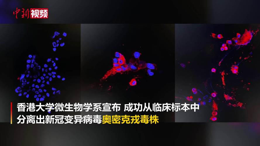 港大成功分离及培养奥密克戎毒株
