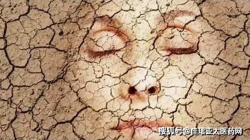 冬季皮肤干燥瘙痒?六个妙招轻松应对