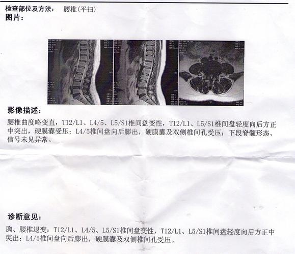 腰骨疼痛怎么办?
