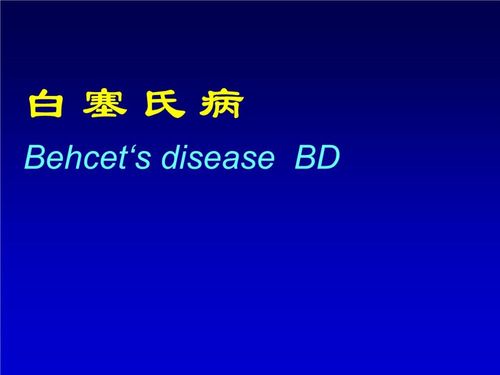 想知道自己是不是得了白塞氏病,知道这四点就够了!