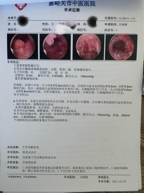嘉峪关市中医医院妇产科宫腔镜———小宫腔,大世界