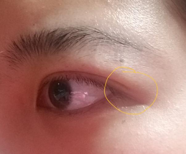 我这种肿双眼皮而且上眼皮很长且下压的眼睛怎么画那种欧美挑眼线以及