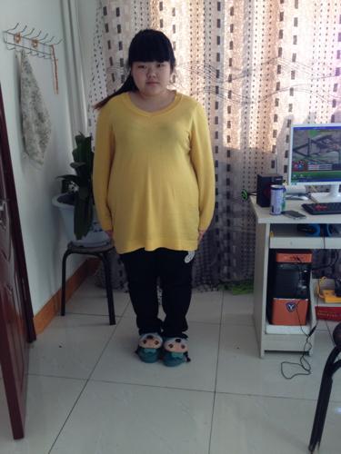 医生好,我现在一米五九,200斤,怀孕大