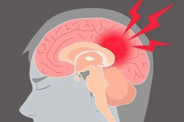 福州男子急性脑梗死!只因