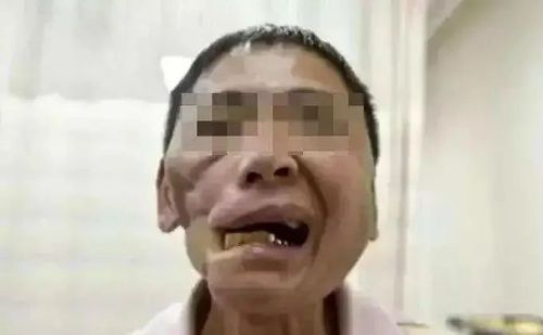 警察一看,嘿,这嘴巴怎么变小了?逃犯说,吃槟榔吃的.