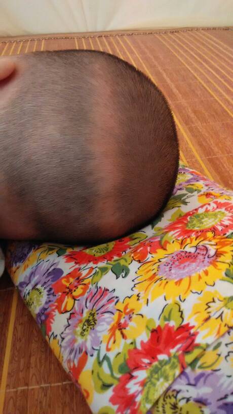 1 分钟前赵力 医师来自汾西县人民医院 答: 你好,亲这个是钙圈