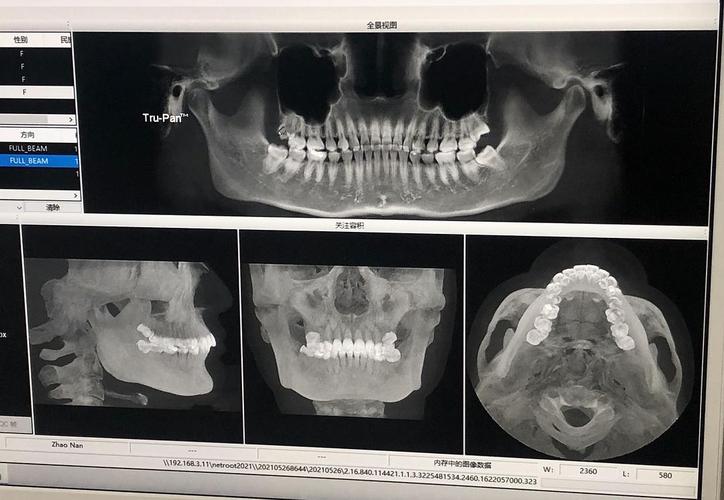 第一次做牙片,朋友们给我点评一下!
