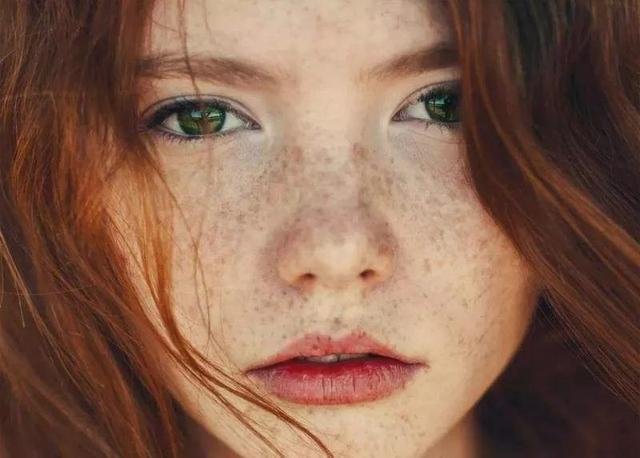 脸上长斑的女性寒露后坚持3个好习惯黄斑减少人显年轻