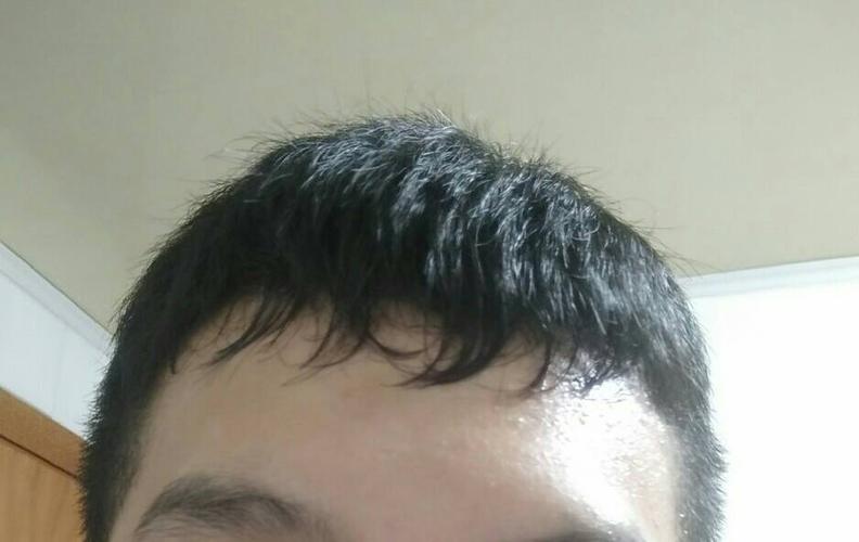 男生头发自然卷,前面的头发会弯曲还一些黏在一起请问怎么弄直