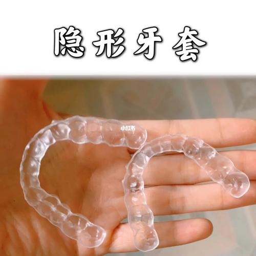 建议青少年佩戴隐形牙套吗?_牙套_杭州攻略_牙齿矫正