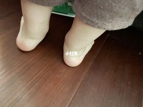 宝宝的脚踝这样正常吗_育儿经验_母婴_母婴_育儿经验