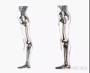 基本上就肯定 是膝盖超伸,很有可能还会伴随 骨盆前倾