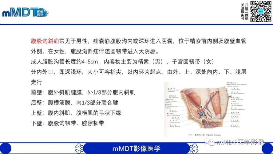 腰疝:通常无症状(宽颈,绞窄少见).