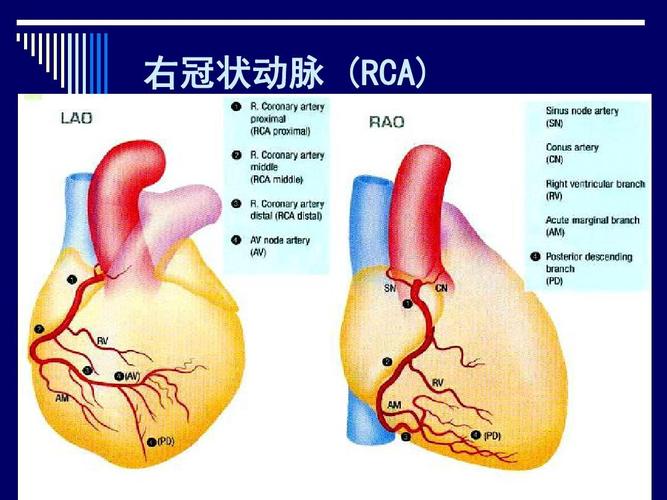 右冠状动脉 (rca)