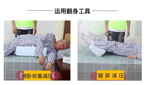 【四川省人民医院】科普小知识:居家卧床老人的压疮预防与处理