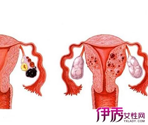 必看女性子宫附件图片 专家带你了解子宫