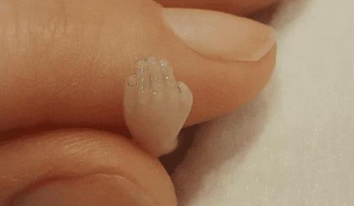 母亲流产后把胚胎存放在冰箱里,后又当做花肥,网友:母爱真伟大