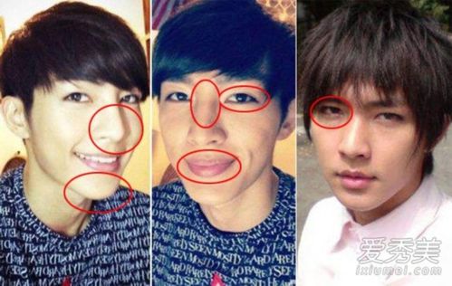 baby下巴 小s鼻子 假体暴露也不承认整容(图)