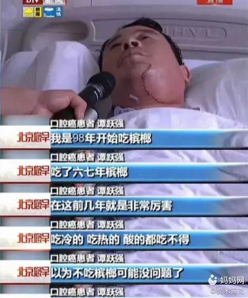 割舌头切牙床,槟榔,这种软性毒品,是中国几千万人的噩梦