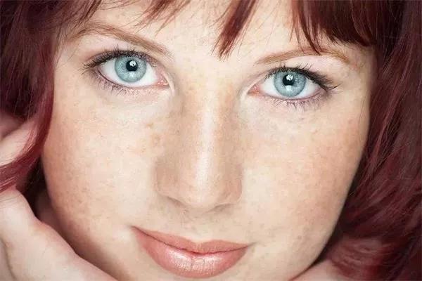 脸上长斑的女人牢记5条护肤常识轻松祛斑恢复白嫩肌肤