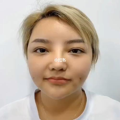 酒窝_甜美可爱_美妆_医美整形