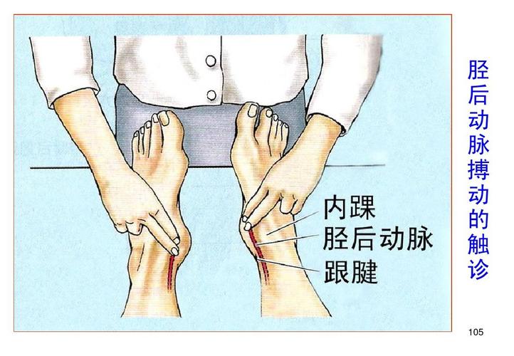 上,下肢动脉的应用解剖ppt