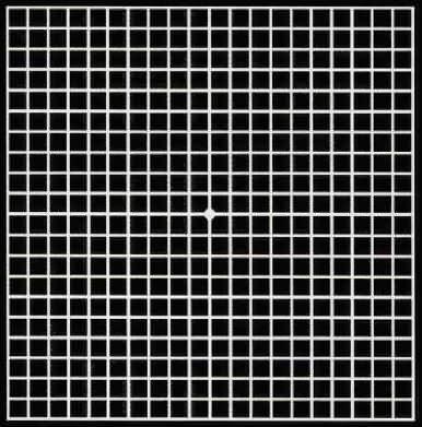 怎样自检黄斑病变