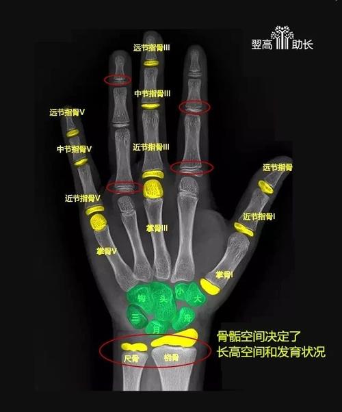 孩子长不高,或许是你不知道这些骨龄知识!