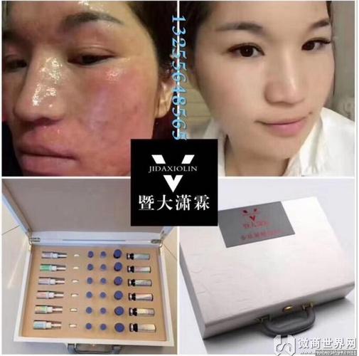 暨大潇霖干细胞靠谱吗?安全吗?效果怎么样?