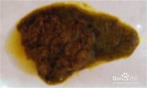 生活/家居 > 生活常识 1 解黑便是上消化道出血的常见病征,多见于溃疡