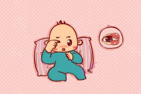 预防宝宝眼结膜炎妈妈应该怎么做