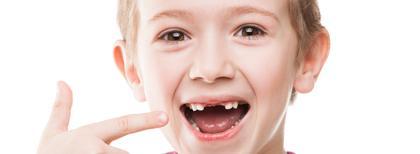 换牙有哪些注意事项 儿童换牙开始时间是什么时候