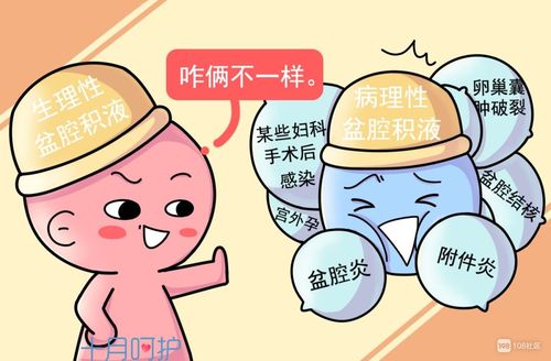 盆腔积液是怎么回事?会影响胎儿发育吗?