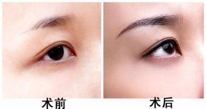 看看专家的介绍:   很多选择做种植眉毛项目手术前,需要检查下血常规