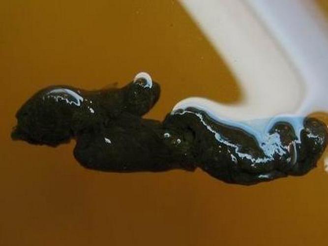  p>便溏是指大便不成形,形似溏泥,俗称薄粪. /p>