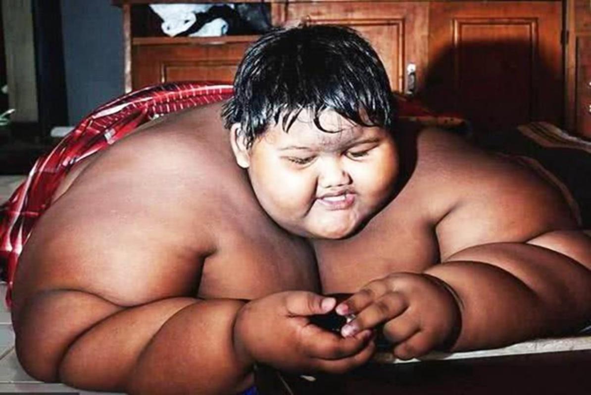 那时只有11岁的他,体重堪比6个同龄小朋友,由于过胖行动不便, 阿里亚