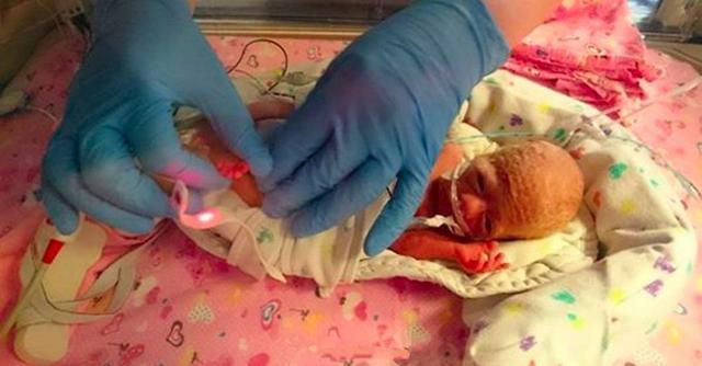 好动而被迫早产的婴儿pixy,凭着顽强的生命力度过了5个月艰难的时期