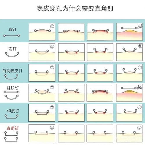 [南明区] 手工穿刺锁骨钉埋钉