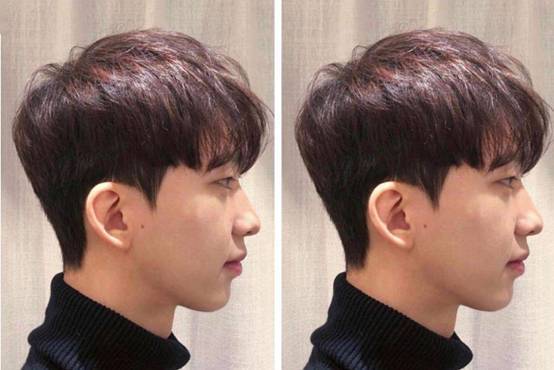 头发做柔顺和软化区别头发做柔顺头发做软化头发做柔顺和软化还是有所