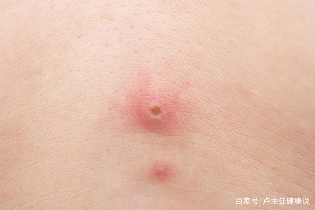 妇科主任:同房时,男性3种行为可能会招来hpv,女人要懂得拒绝