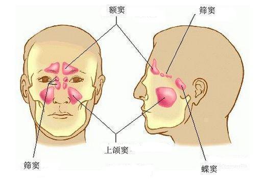 眼睛胀痛找不到原因?可能患有鼻窦炎