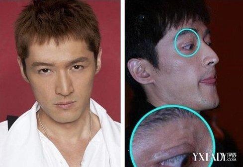 【图】胡歌毁容前后对比照片 从何炅手上抢走了李逍遥